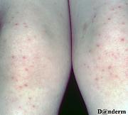 Click image for larger version

Name:	hfm.jpg
Views:	44
Size:	68.0 KB
ID:	982196